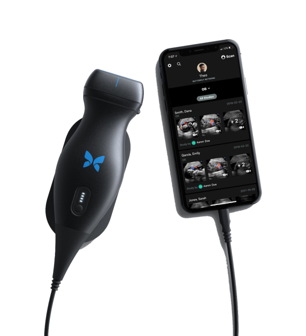 ultrasonido butterfly